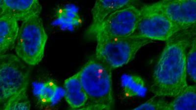 Dividing cancer cells