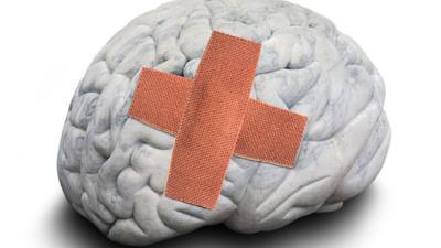 Brain with plaster on