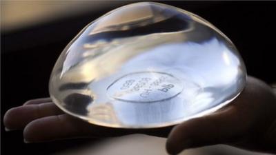 Breast implant