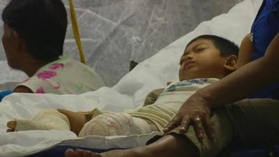 Young boy with bandages on legs