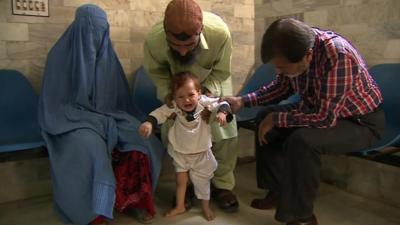 A child suffering from polio because of a lack of access to a vaccine