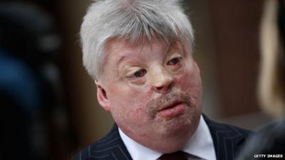 Falklands veteran Simon Weston