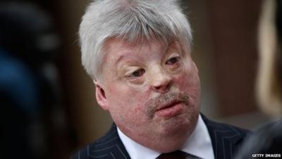 Falklands veteran Simon Weston