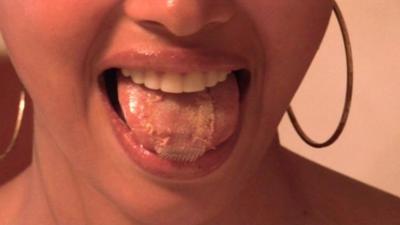 Venezuelan beauty queen shows off mesh on her tongue to help her diet