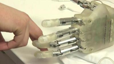 Bionic hand