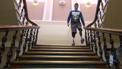 Gregg Stevenson using the stairs with prosthetics