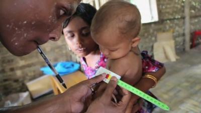 Doctor checking young child