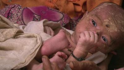 Baby in Rakhine state Myanmar