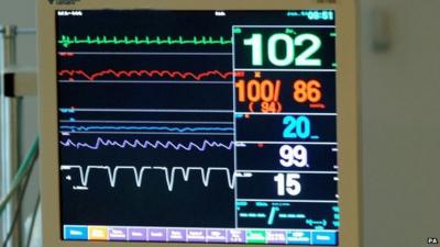 Intensive Care Unit monitor