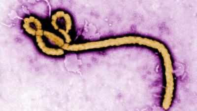 Ebola virus