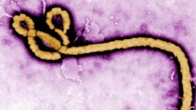 Ebola virus