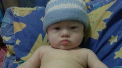 Gammy, the baby boy abandoned by an Australian couple