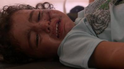 Three-year-old girl in Gaza hospital