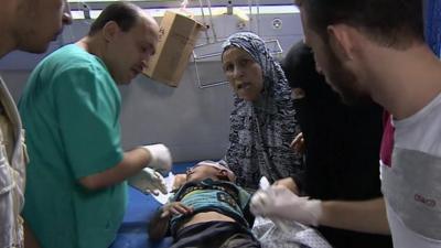 Doctors and family surround a child at the al-Shifa hospital in Gaza City