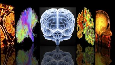 Conceptual computer artwork depicting neurology