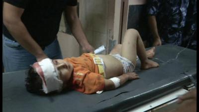 Injured child in Gaza