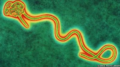 Coloured transmission electron micro graph of a single Ebola virus, the cause of Ebola fever