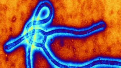 Ebola virus