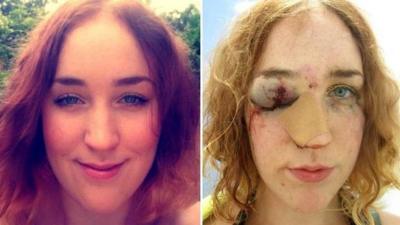 Pictures before and after the attack on Mary Brandon
