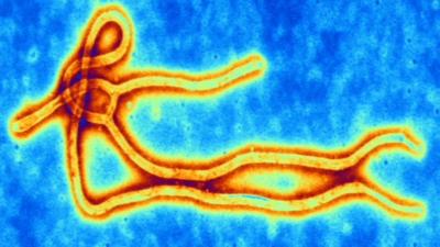 The first reported Ebola virus outbreak occurred in 1976 in Africa