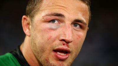 Sam Burgess