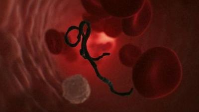 Ebola virus in bloodstream - graphic