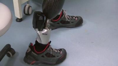 A prosthetic leg