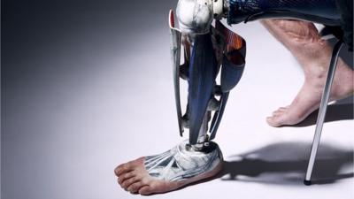 prosthetic limb