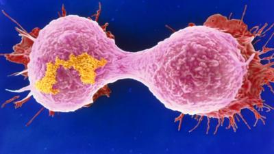 A dividing breast cancer cell