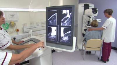 Medical staff look at a mamogram