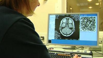 Clinician reviews brain scan