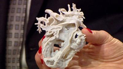 Mina's 3D printed heart