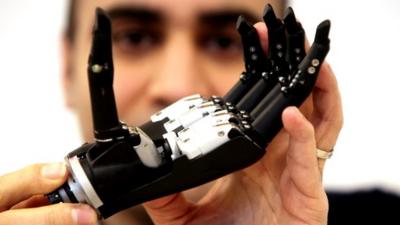 Bionic hand