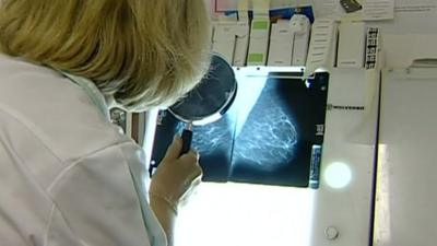 Breast cancer screening