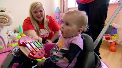 Harmonie-Rose, who lost part of her limbs and face after contracting meningitis B