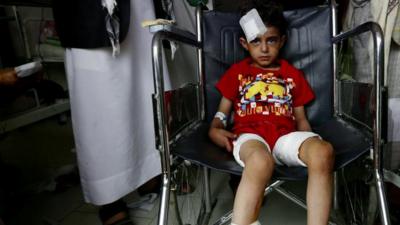 Injured child sits on wheelchair