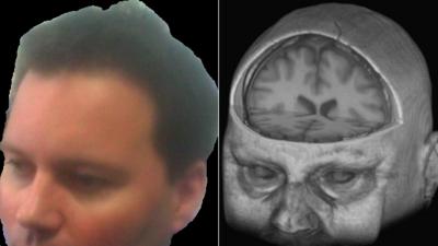 Owain Clarke and the image of his brain