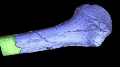 3D scan of a bone