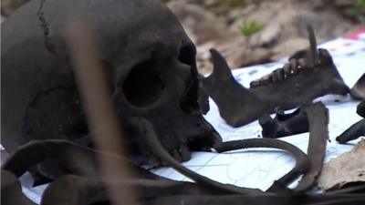 The skull and jawbone of a Russian soldier