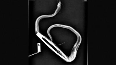 A snake that has gobbled up some tongs