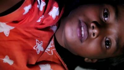 Close up of child Rohingya Muslim refugee, Rashida, in a camp for migrants in Indonesia