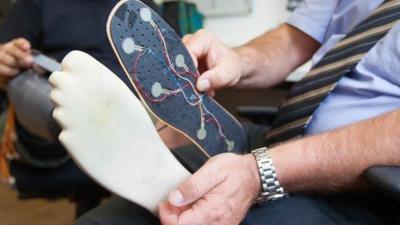 Sensors on the prosthetic foot link to nerves