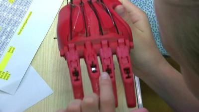 Prosthetic hand being assembled