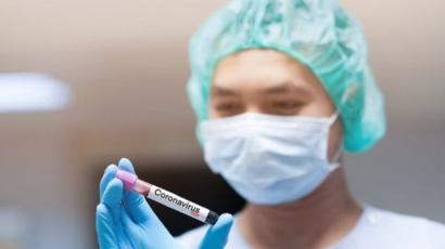 Médico manipula frasco com sangue para exame de coronavírus