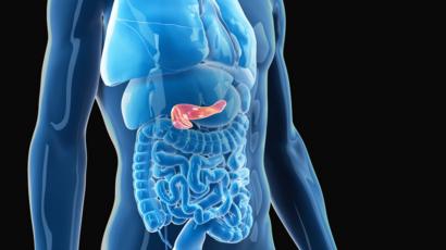 diabetes mellitus tipo 2 sintomas de cancer diabetes mellitus tipo 2 sintomas de cancer
