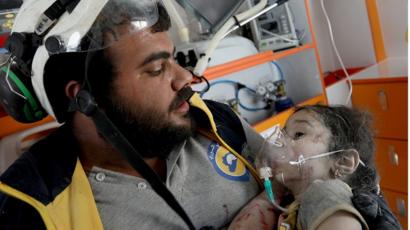 أحد عناصر الخوذ البيض يقدم المساعدة الطبية لطفلة سورية مصابة