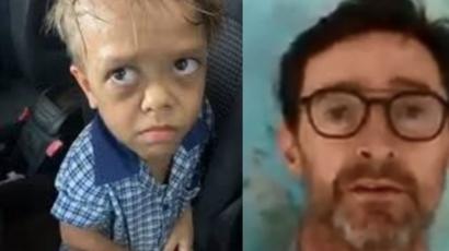 Quaden Bayles Australian Boy In Bullying Video Receives Global