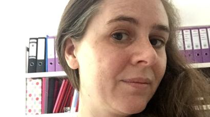 Sepsis Diagnosis Turned My Hair White Bbc News