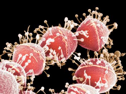 صورة مجهرية ملونة للفيروسات البكتيرية تهاجم نوعا من البكتيريا.