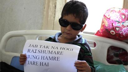 طفل مصاب برصاص الشرطة في كشمير يرفع لافتة
